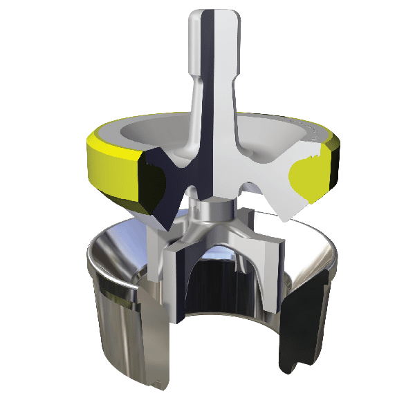 Weir Novatech Valves & Seats Acumen